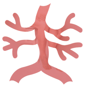 Trombose