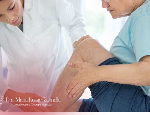 Quando Procurar um Cirurgião Vascular?