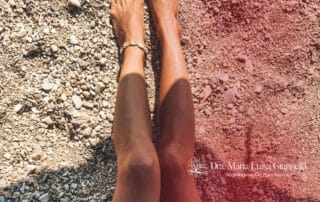 Doenças Venosas no Verão