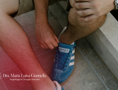 O que Causa Varizes nos Homens?