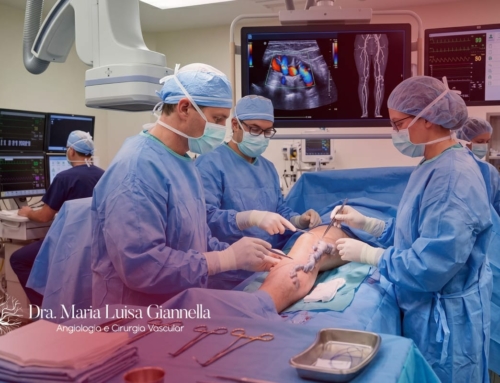 Problemas na Veia Safena – Quando a Cirurgia é Necessária?