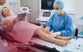 Cirurgia de Varizes com Anestesia Local