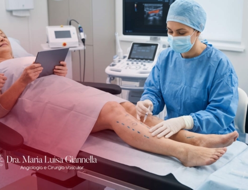 É Possível Realizar a Cirurgia de Varizes com Anestesia Local?