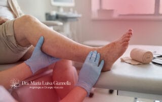 Dermatite de Estase
