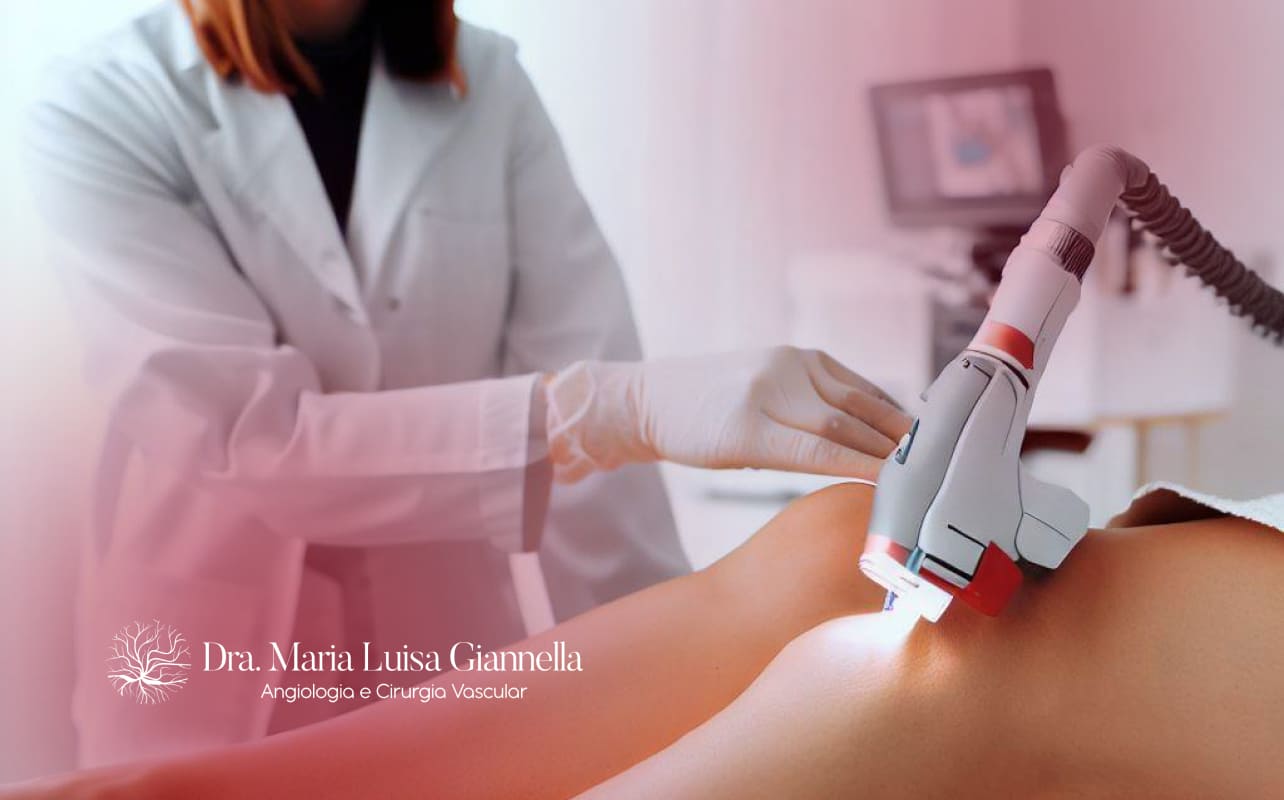 Cirurgia de Varizes a Laser