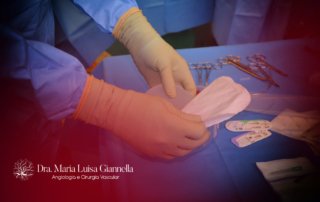 Cirurgia de Varizes