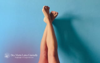 Cuidados Após o Tratamento de Varizes com Laser