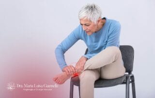 Inflamação nas Varizes