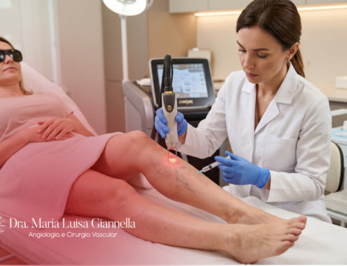 Laser Transdérmico associado à Escleroterapia: Conheça esta Opção de Tratamento